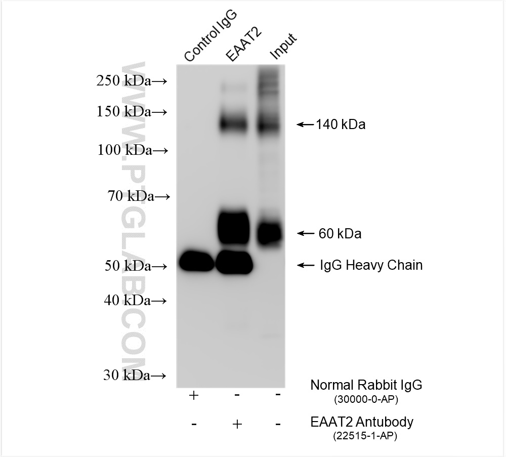 IP experiment of mouse brain using 22515-1-AP