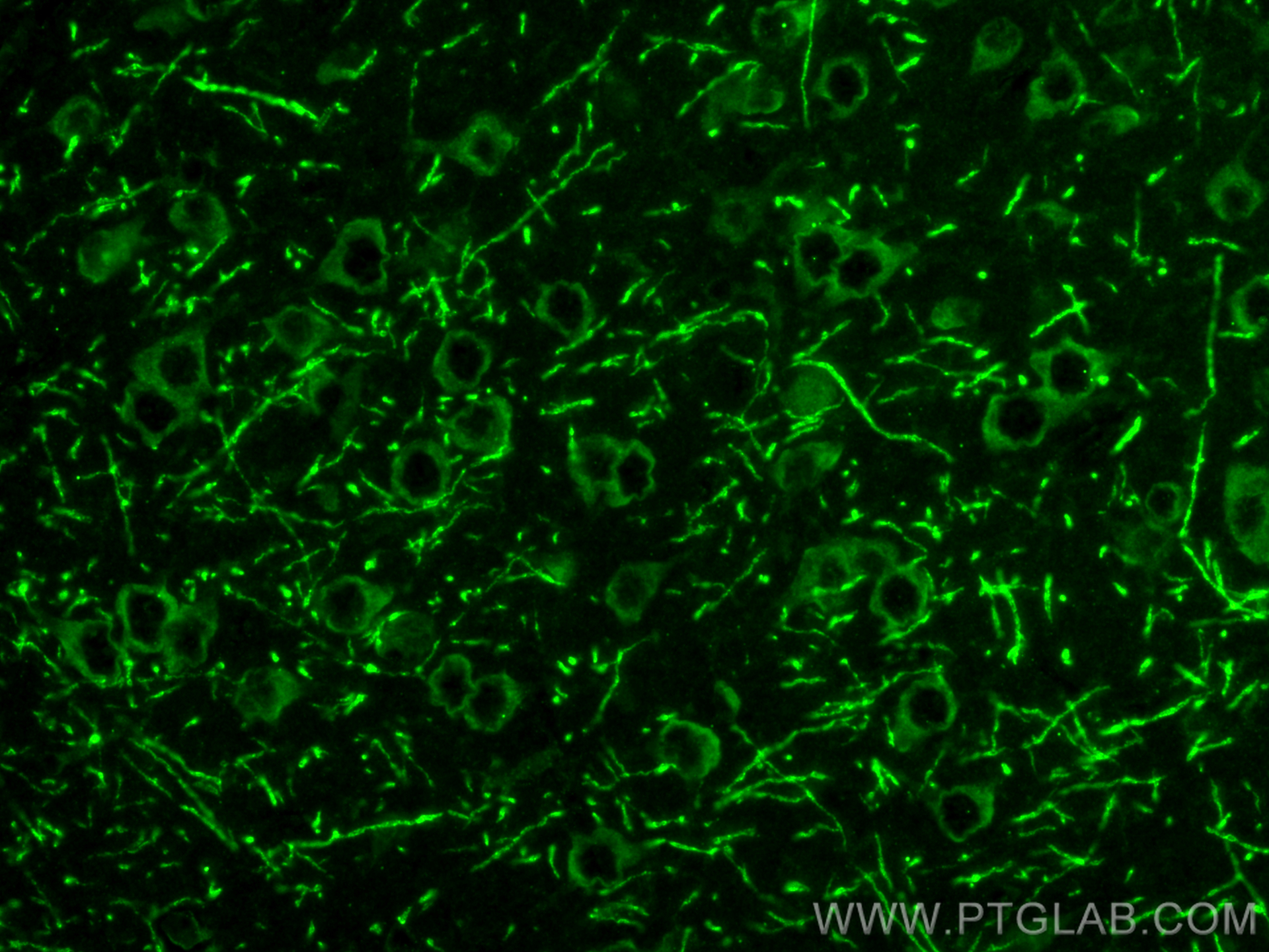 IF Staining of mouse brain using 12820-1-AP