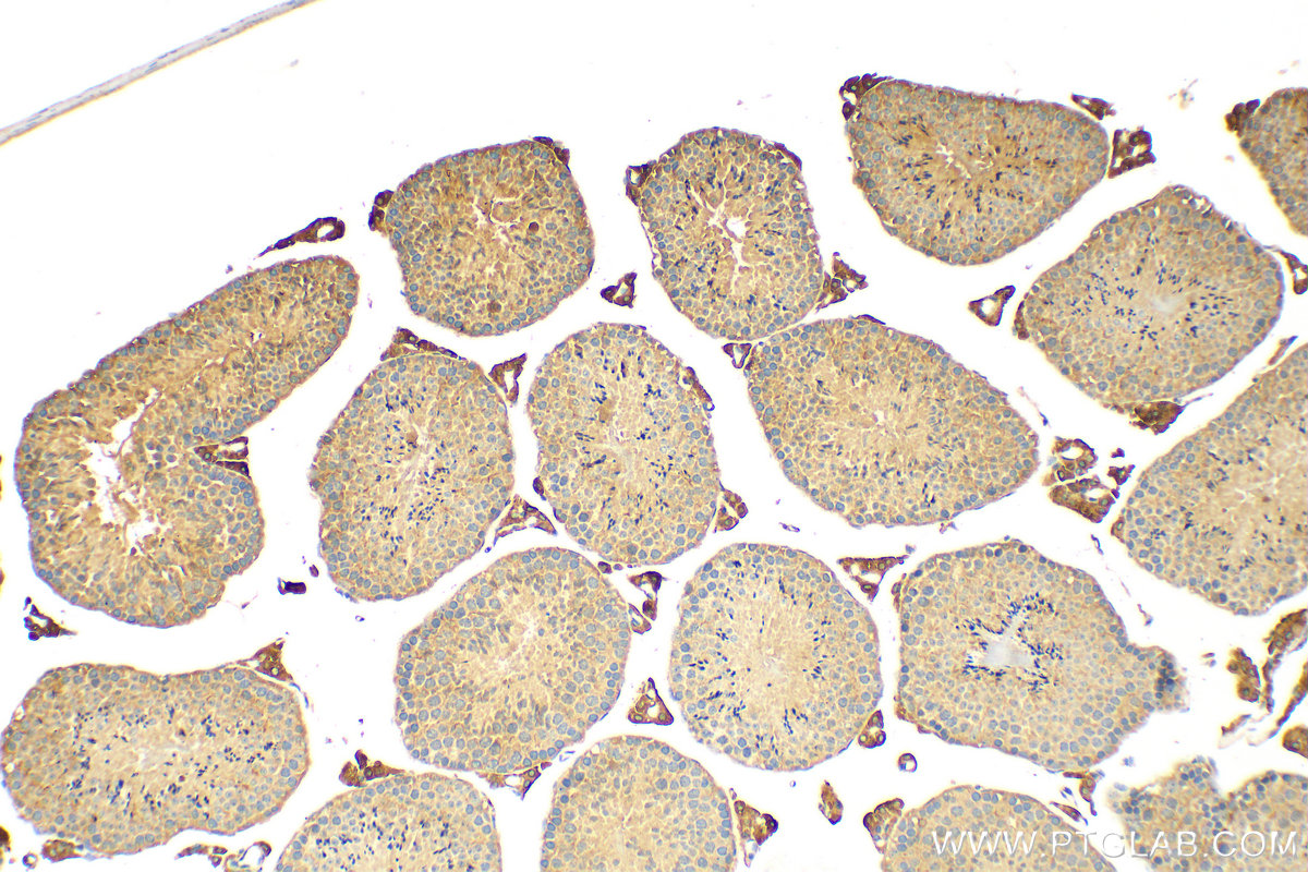 IHC staining of mouse testis using 12820-1-AP