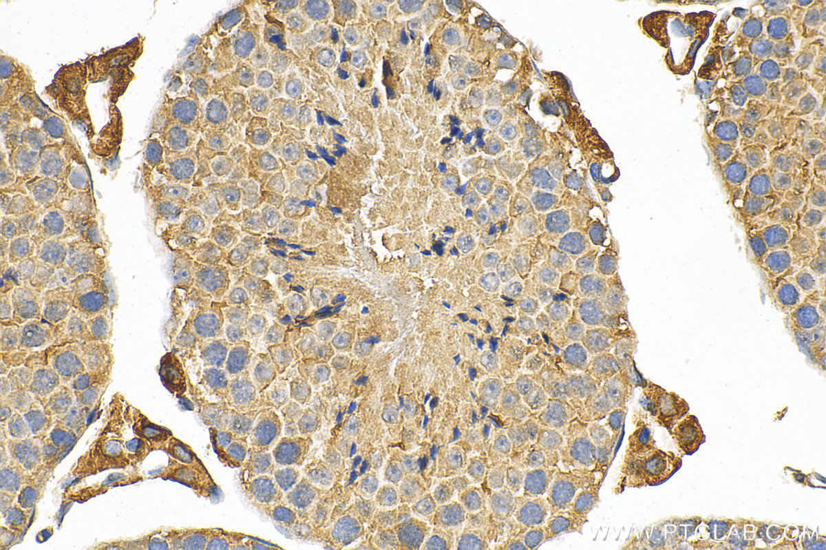 IHC staining of mouse testis using 12820-1-AP