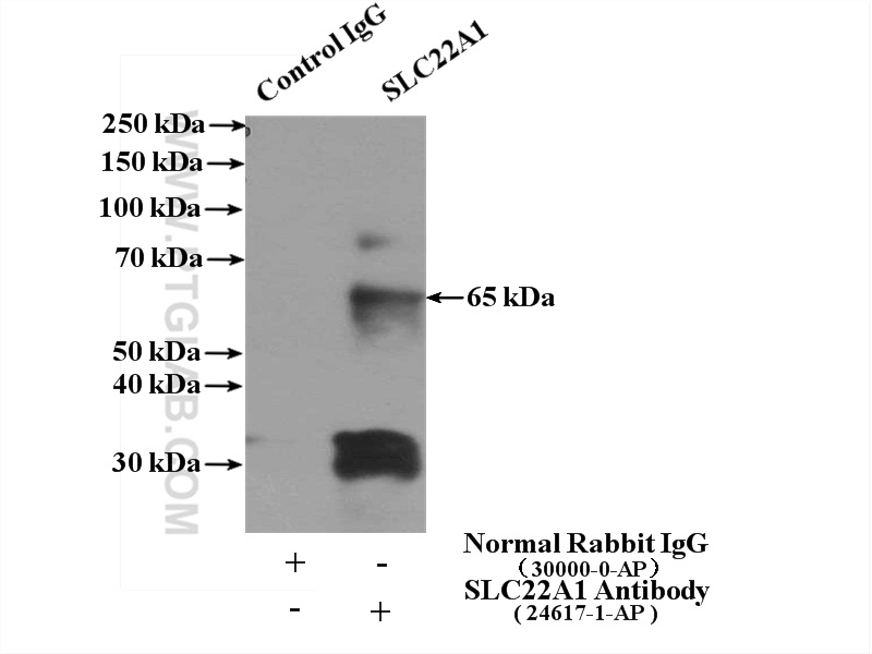 IP experiment of mouse liver using 24617-1-AP