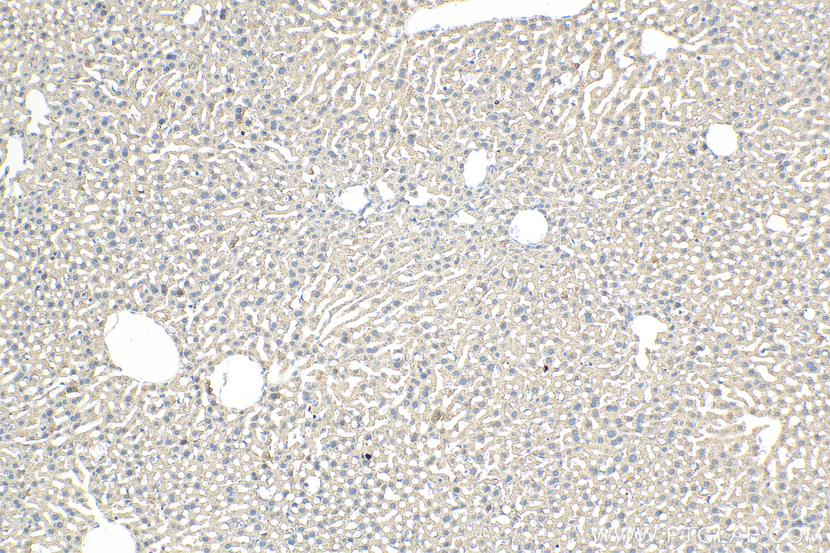 IHC staining of mouse liver using 31069-1-AP