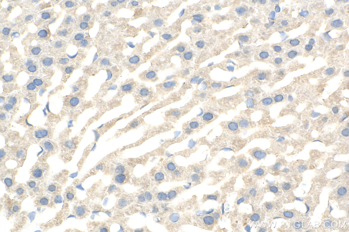 IHC staining of mouse liver using 31069-1-AP