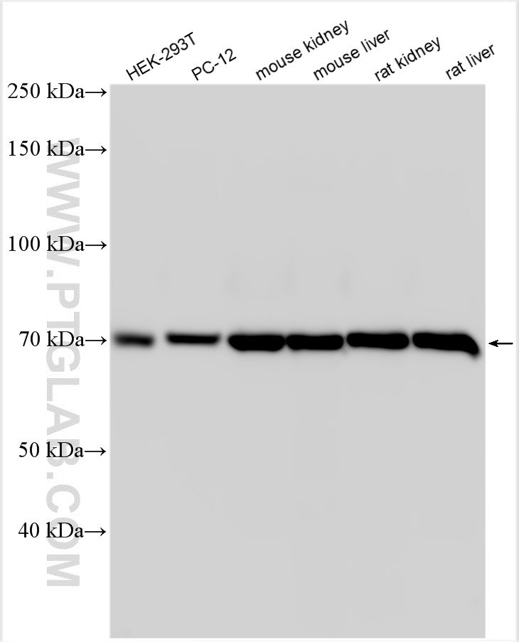 WB analysis using 31069-1-AP