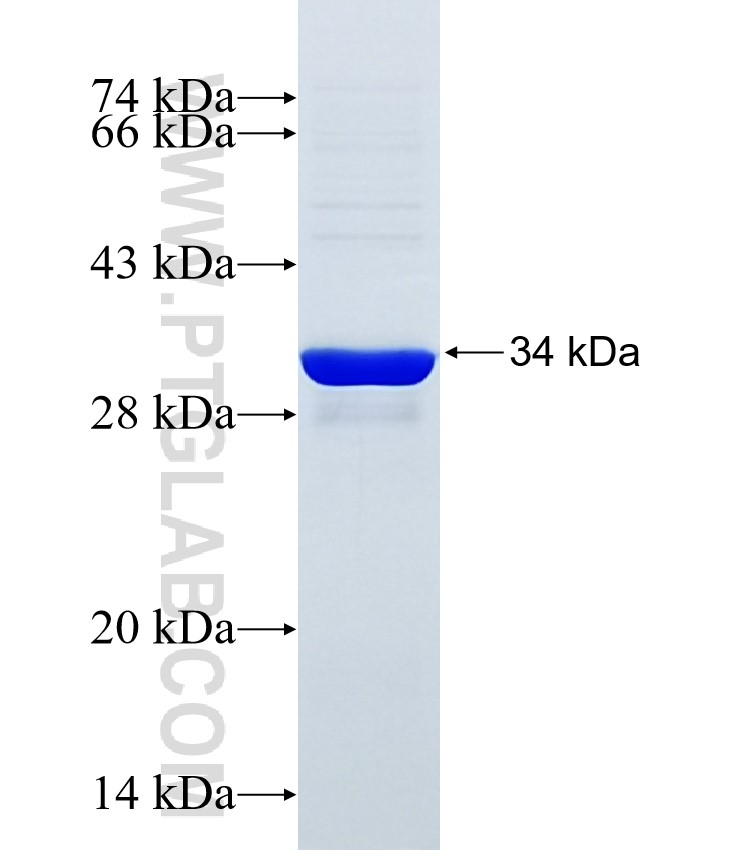 SLC22A10 fusion protein Ag34521 SDS-PAGE