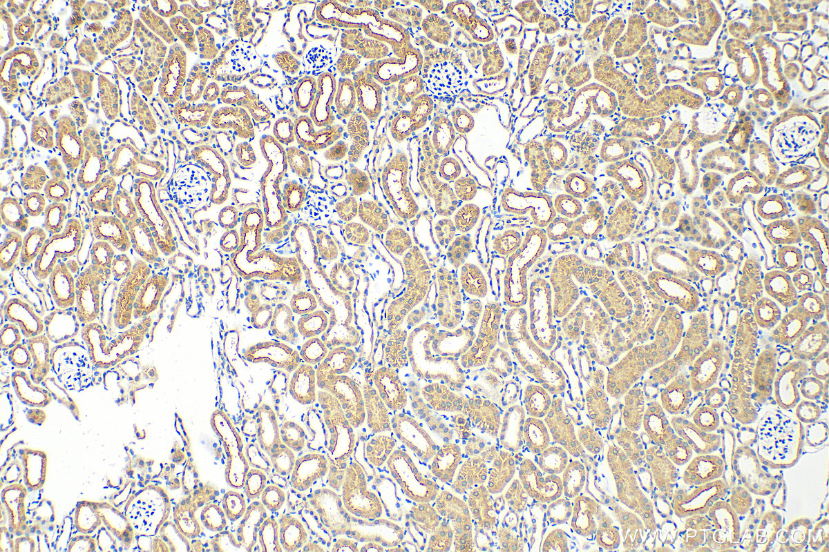 IHC staining of mouse kidney using 14937-1-AP