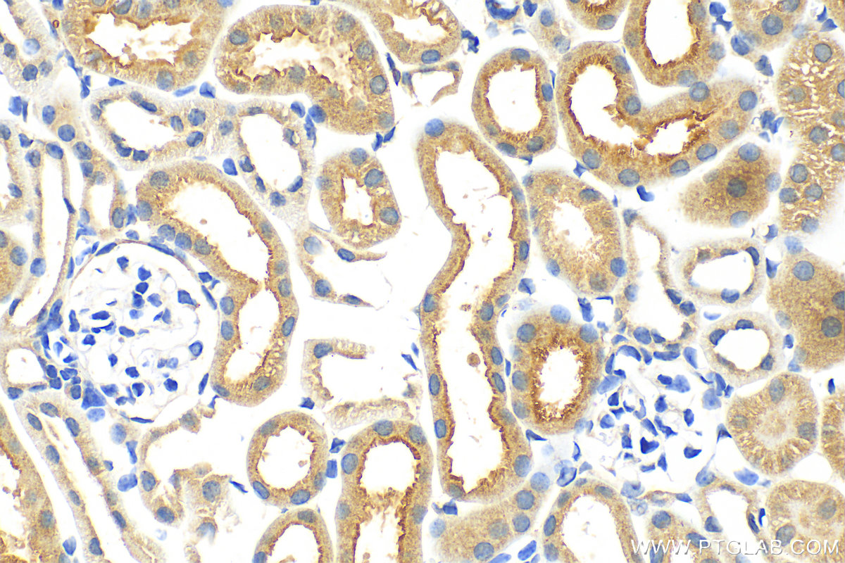 IHC staining of mouse kidney using 14937-1-AP