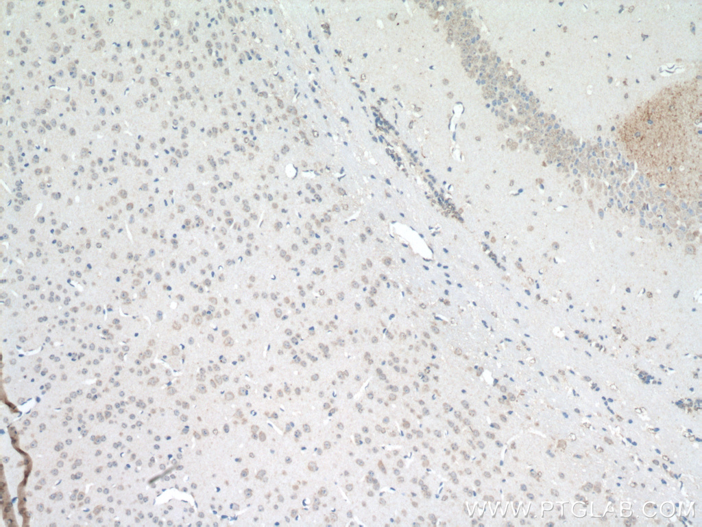 IHC staining of mouse brain using 24901-1-AP