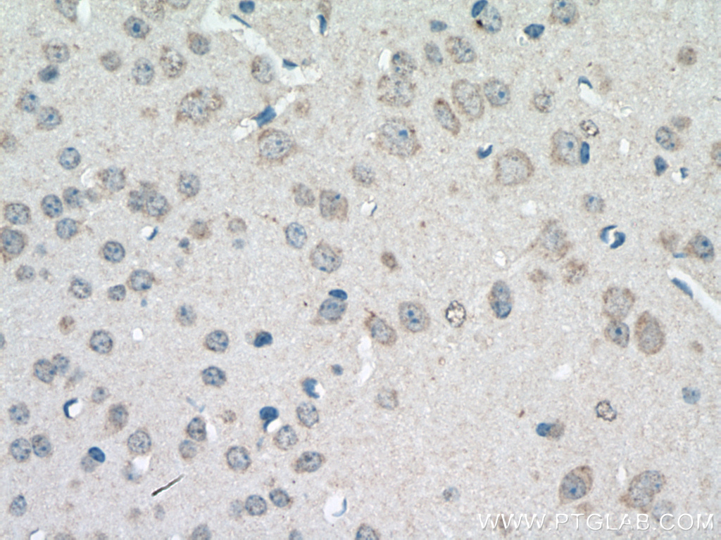 IHC staining of mouse brain using 24901-1-AP