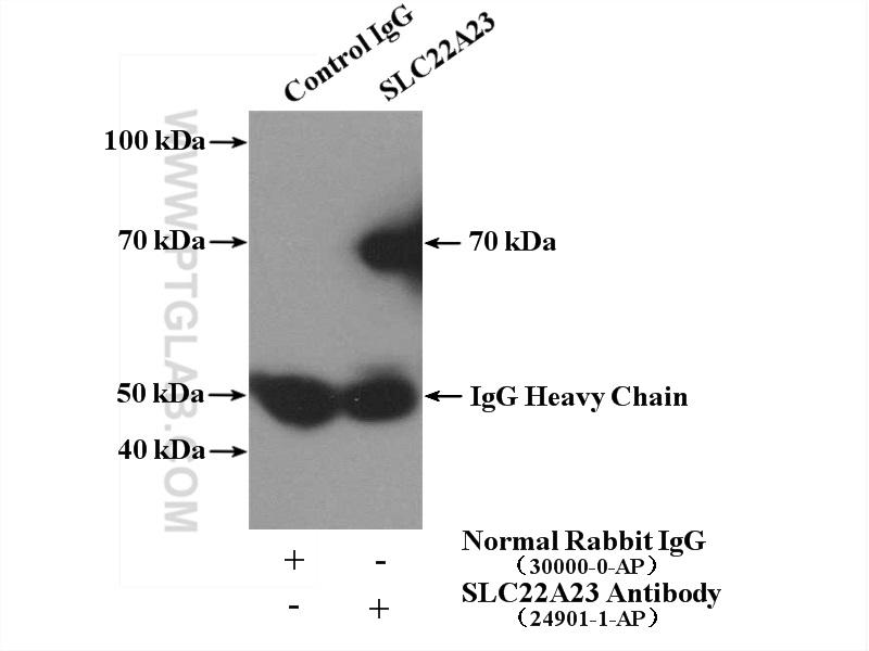 IP experiment of mouse liver using 24901-1-AP