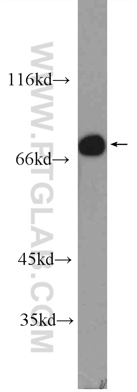 WB analysis of L02 using 24901-1-AP