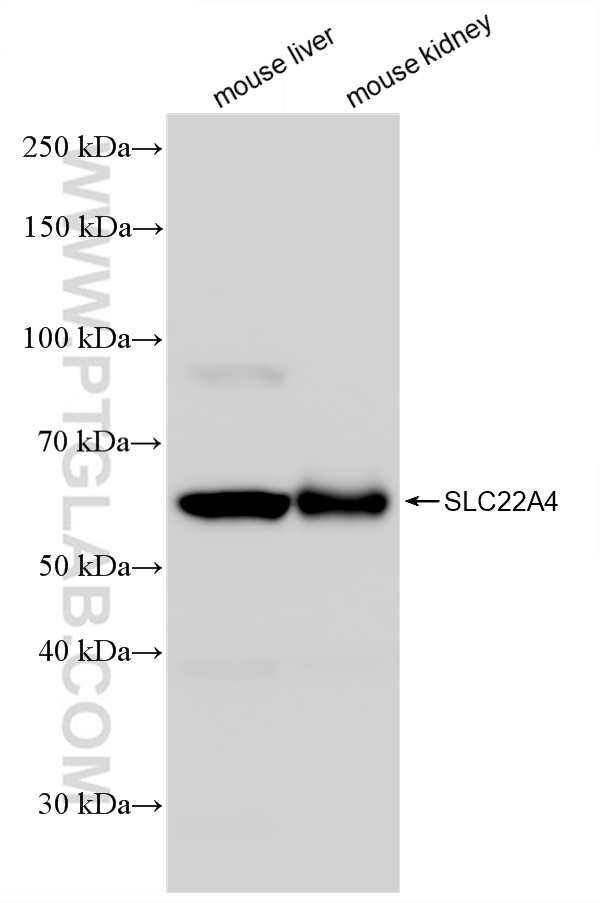 WB analysis using 83192-1-RR (same clone as 83192-1-PBS)