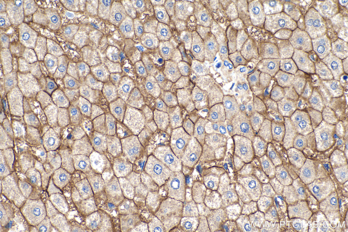 IHC staining of human liver using 26796-1-AP