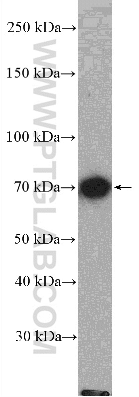 WB analysis of mouse kidney using 26796-1-AP