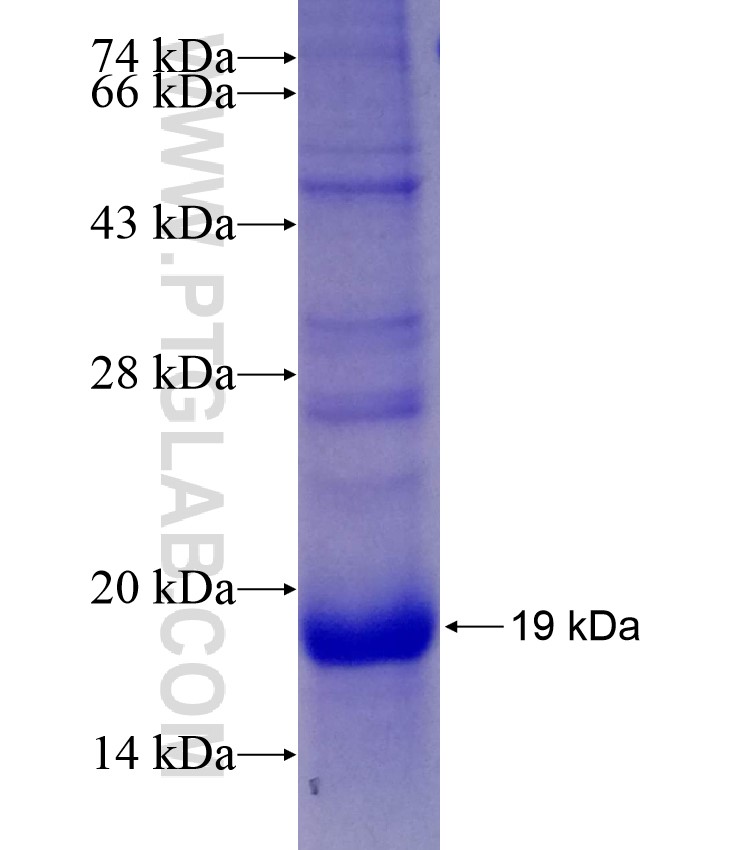 SLC24A6 fusion protein Ag28430 SDS-PAGE