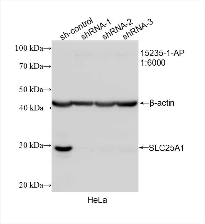 WB analysis of HeLa using 15235-1-AP