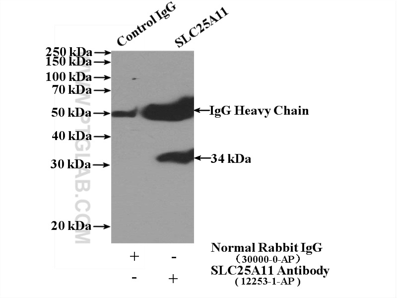 IP experiment of HEK-293 using 12253-1-AP