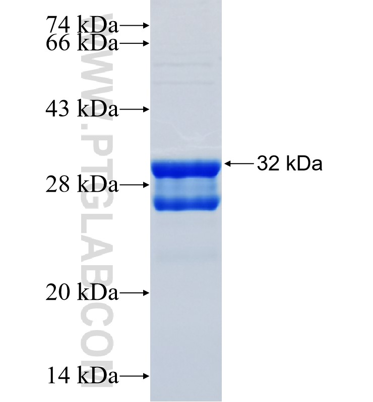 SLC25A17 fusion protein Ag34310 SDS-PAGE