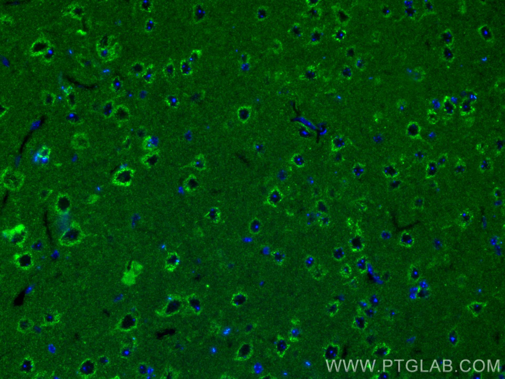 IF Staining of mouse brain using 25402-1-AP