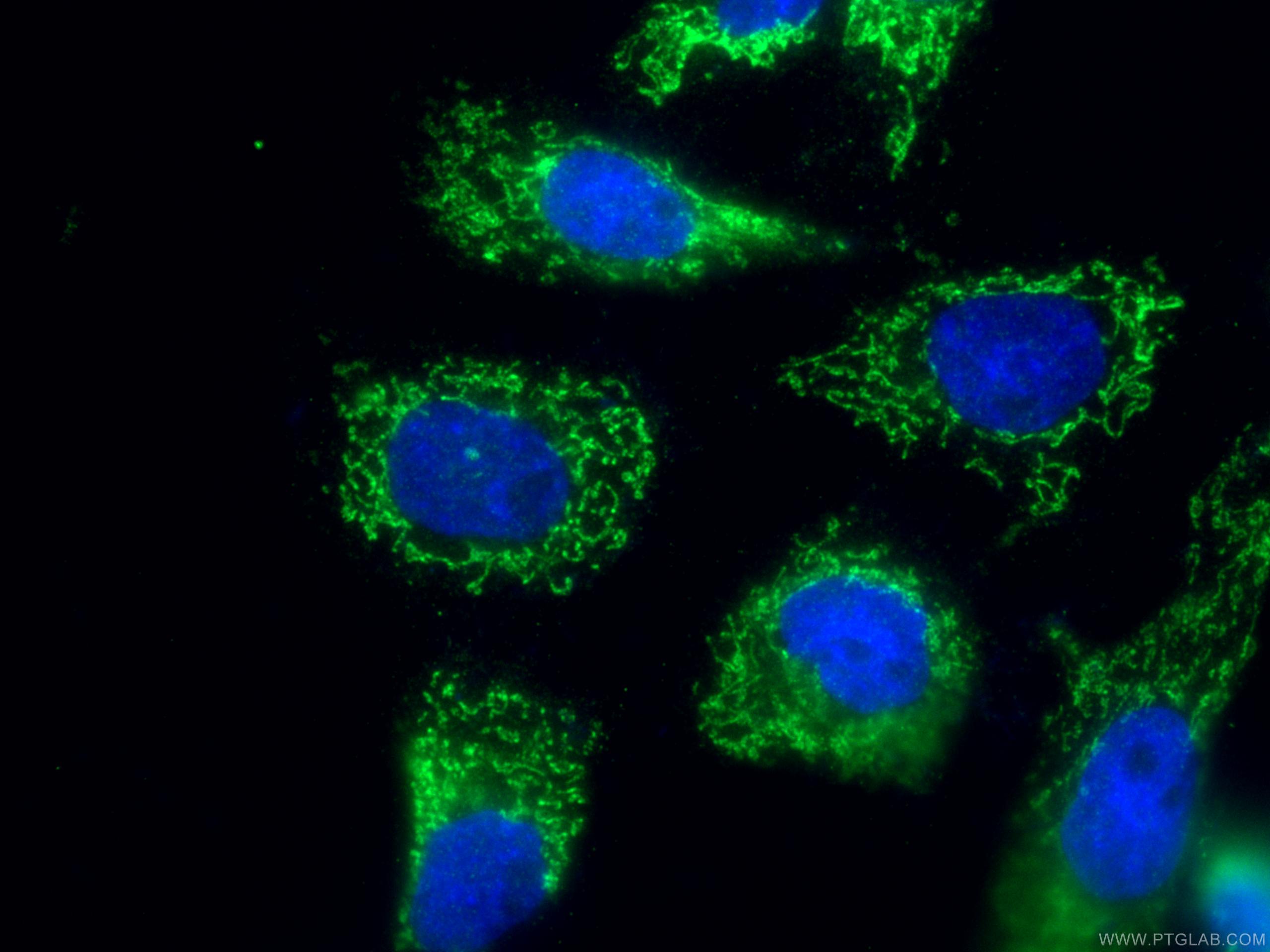 IF Staining of A431 using 14669-1-AP (same clone as 14669-1-PBS)