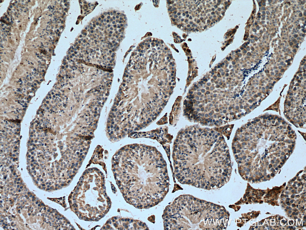 IHC staining of mouse testis using 14669-1-AP (same clone as 14669-1-PBS)