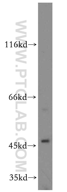 WB analysis of HEK-293 using 14669-1-AP (same clone as 14669-1-PBS)