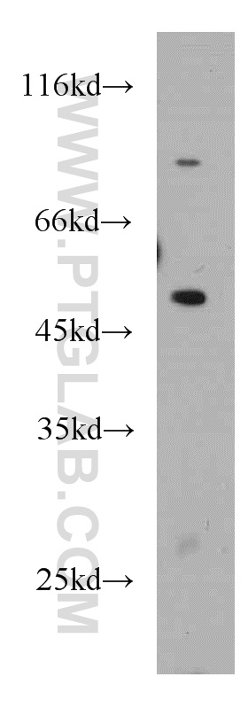 WB analysis of RAW264.7 using 21568-1-AP