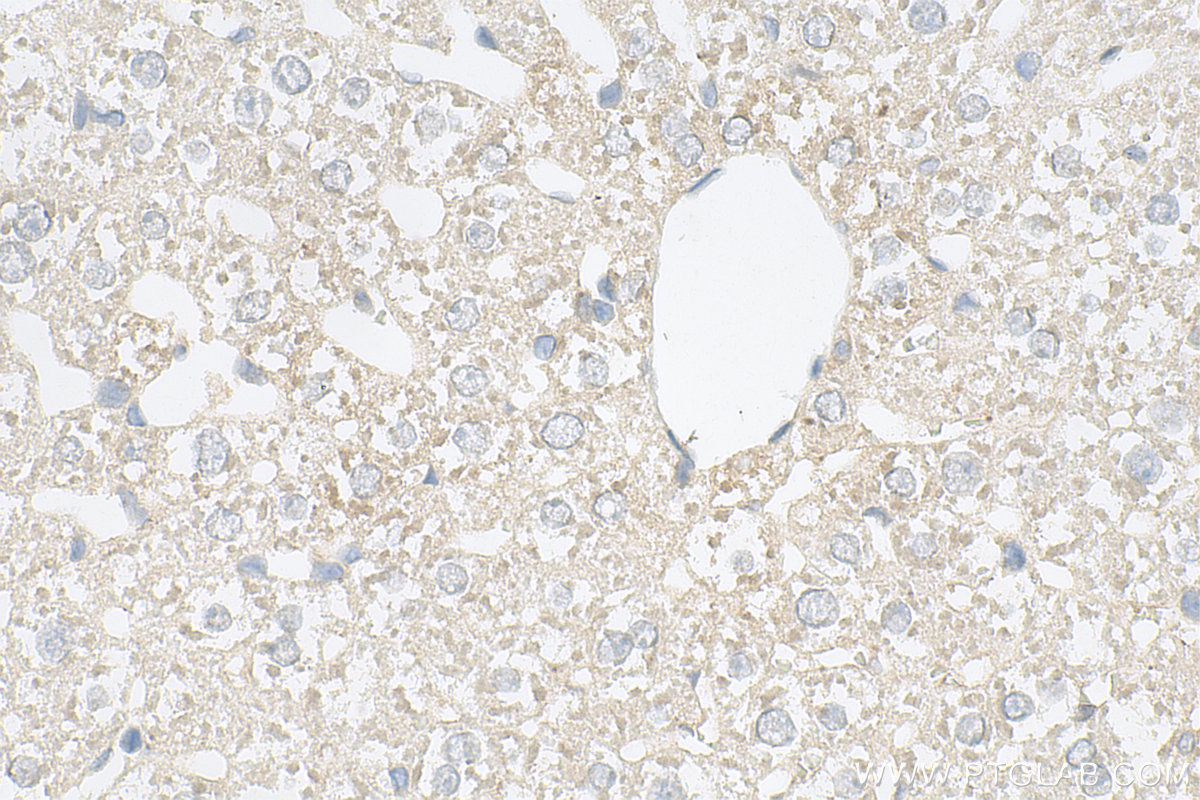 IHC staining of rat liver using 10420-1-AP