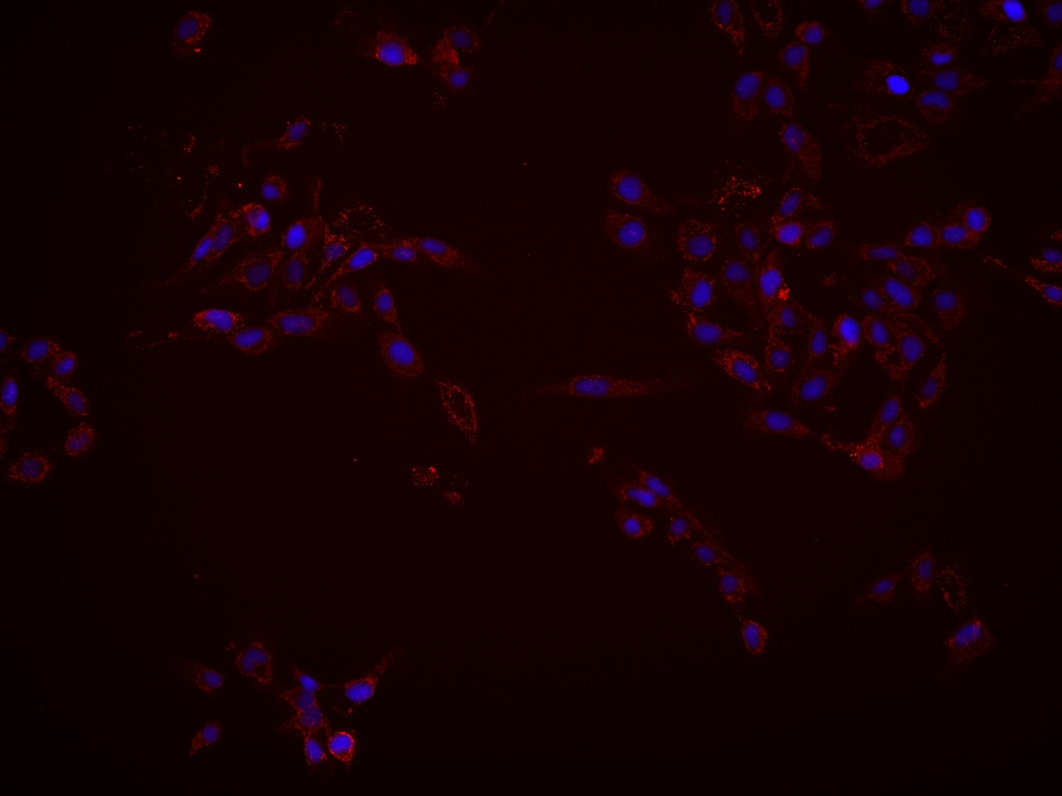 IF Staining of A431 using 67896-1-Ig