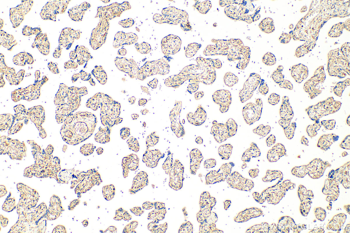 IHC staining of human placenta using 20615-1-AP