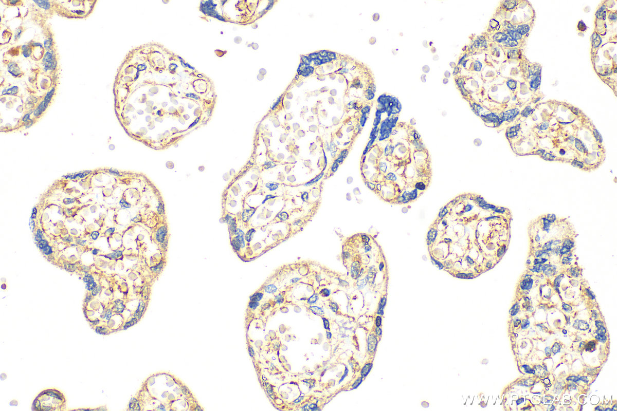 IHC staining of human placenta using 20615-1-AP