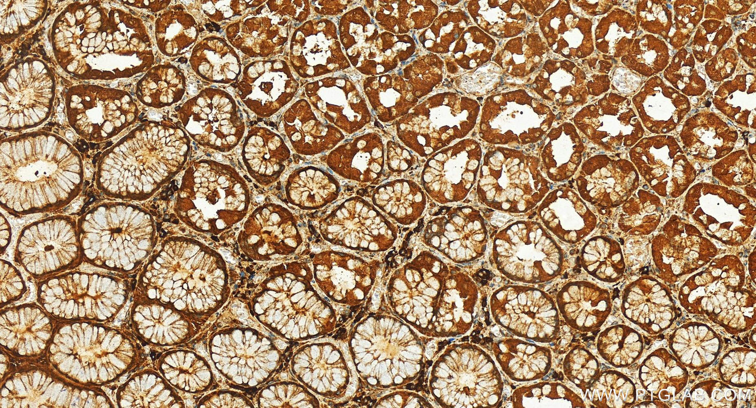 IHC staining of human stomach using 12277-1-AP