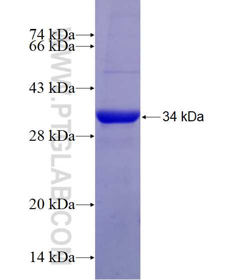 SLC25A46 fusion protein Ag28409 SDS-PAGE