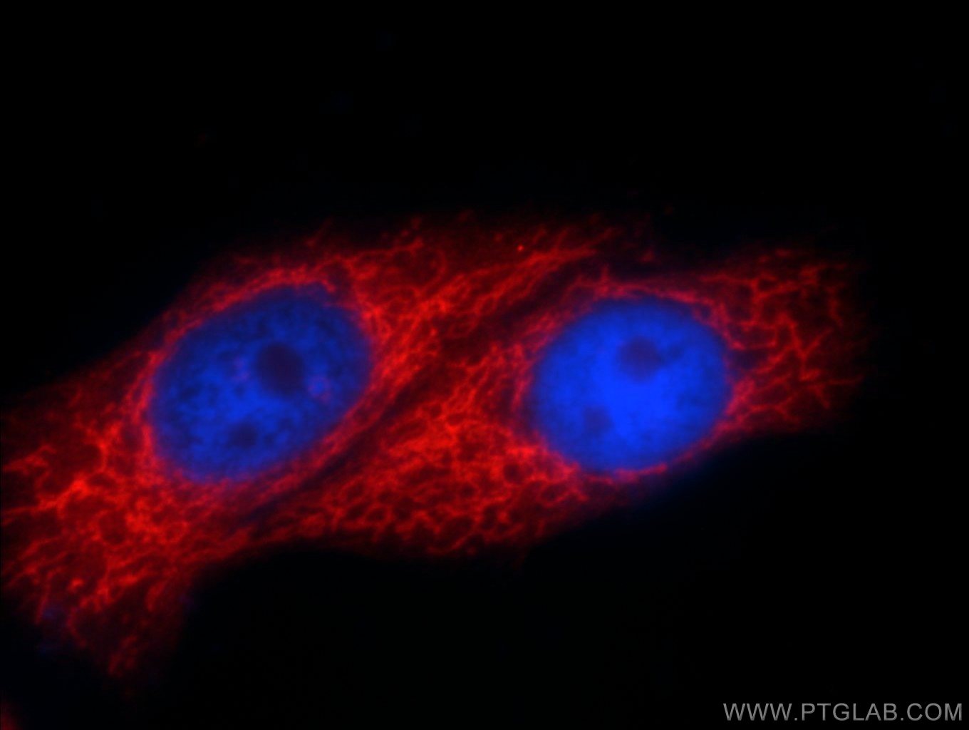 IF Staining of HepG2 using 14841-1-AP