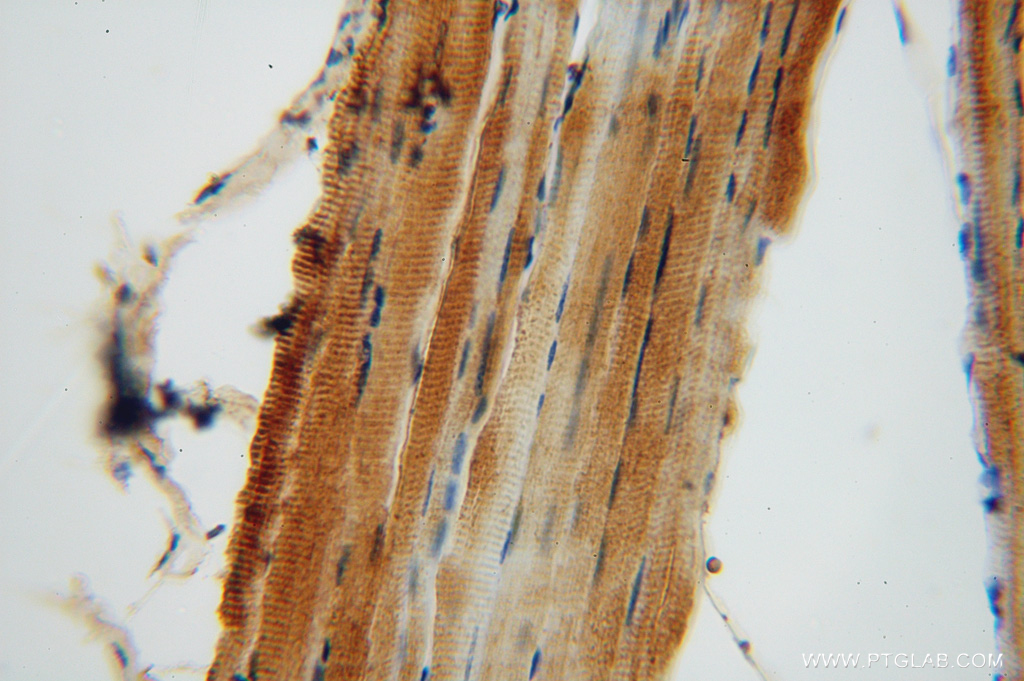 IHC staining of human skeletal muscle using 14841-1-AP