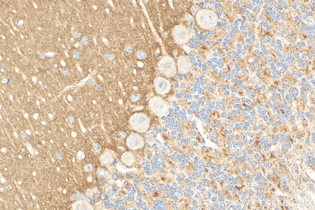 IHC staining of mouse cerebellum using 14156-1-AP