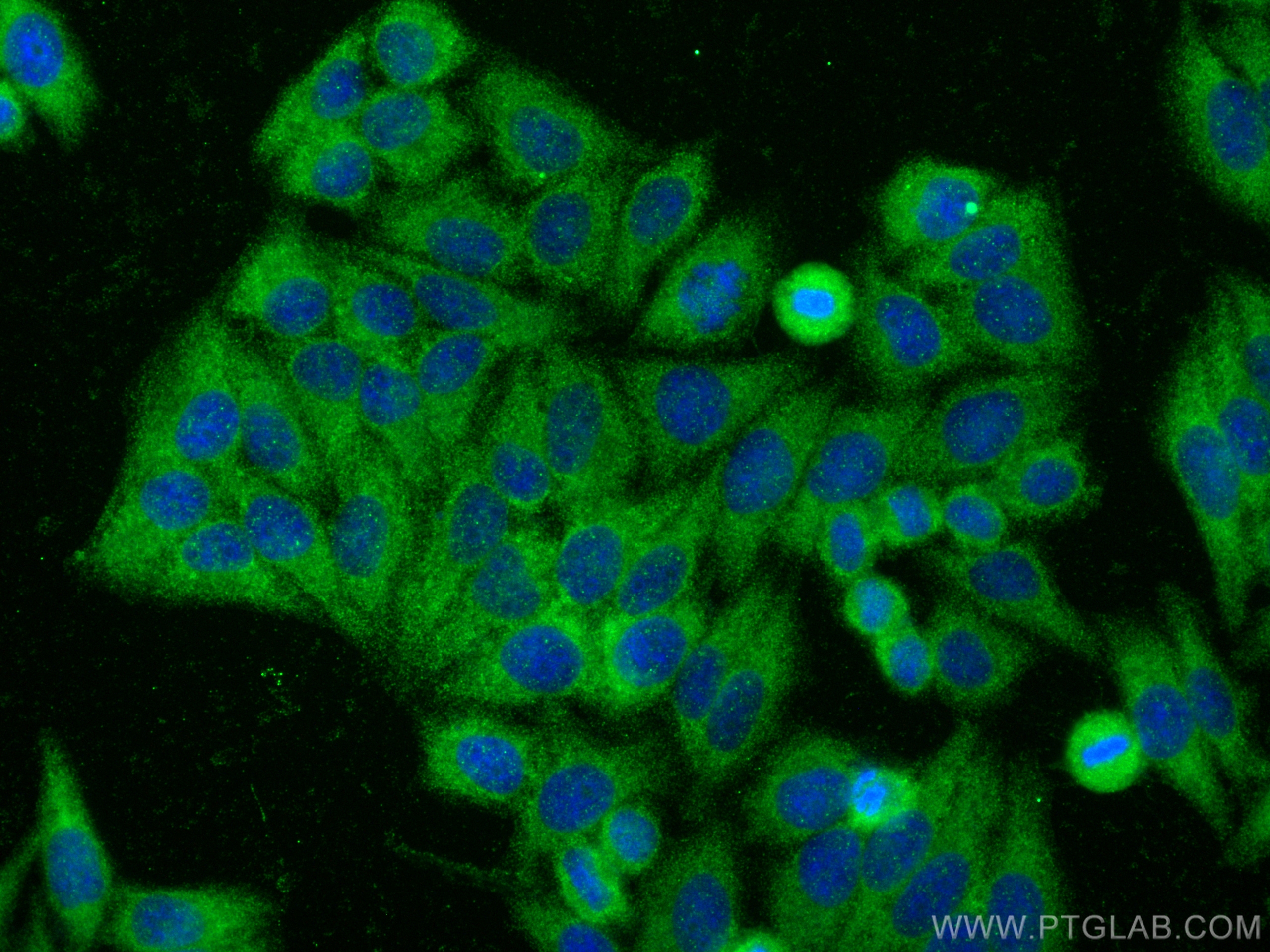 IF Staining of HepG2 using 27759-1-AP