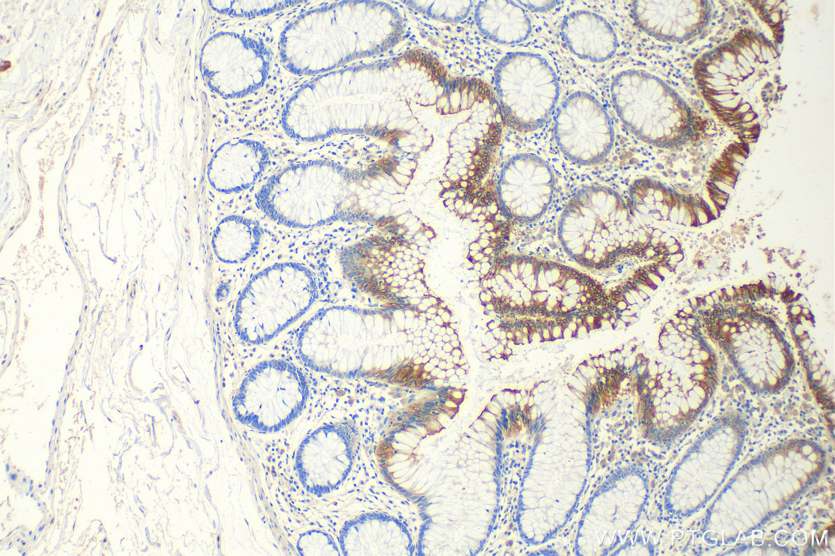 IHC staining of human colon using 13165-1-AP