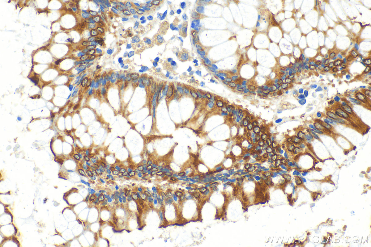 IHC staining of human colon using 13165-1-AP