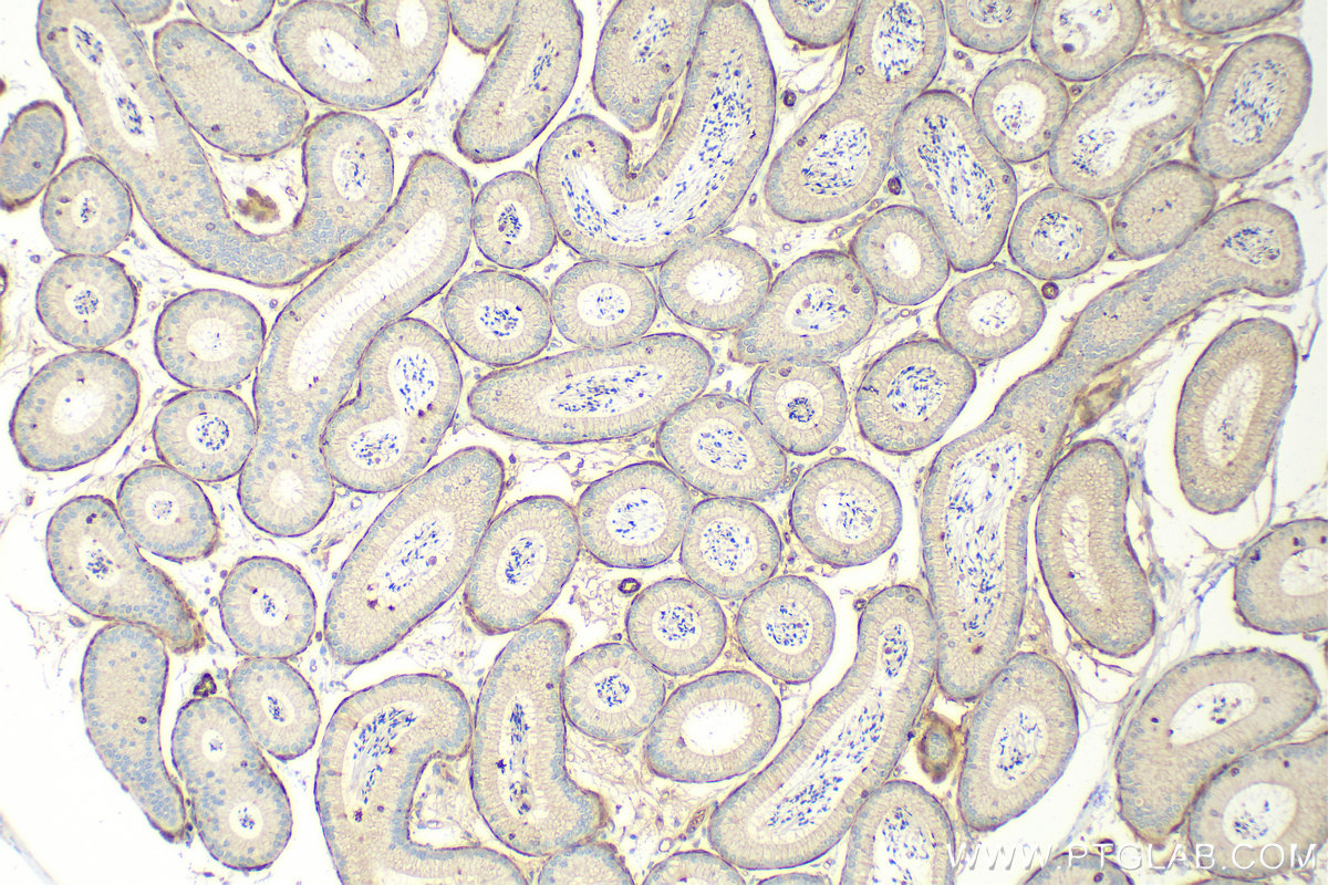 IHC staining of mouse testis using 13165-1-AP