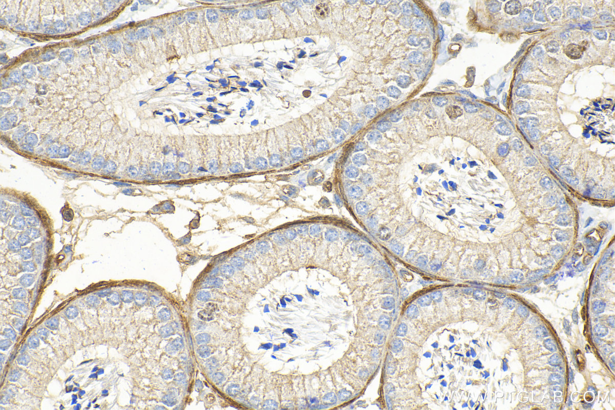 IHC staining of mouse testis using 13165-1-AP