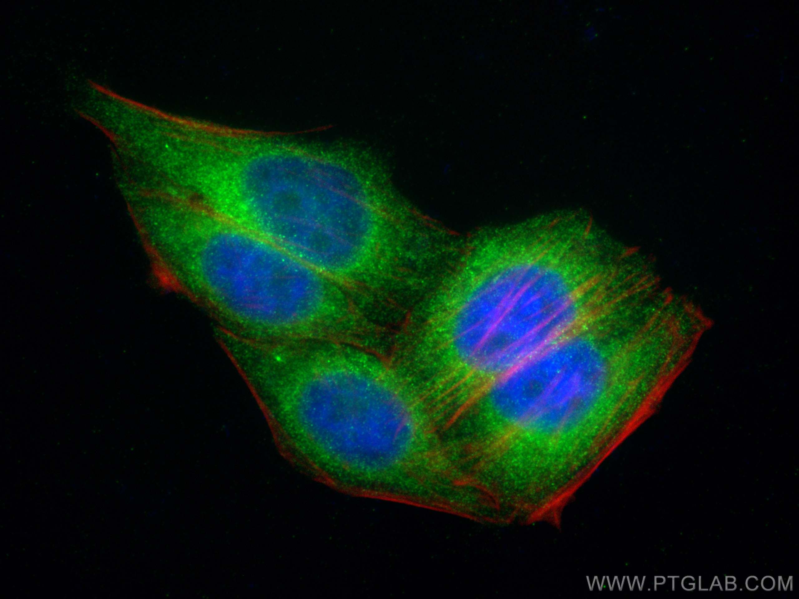 IF Staining of HepG2 using 14048-1-AP