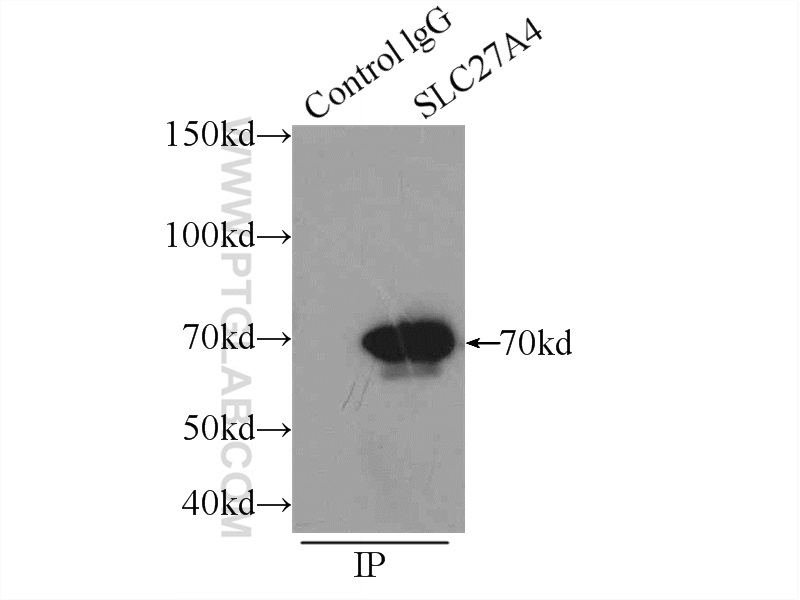 IP experiment of HepG2 using 11013-1-AP