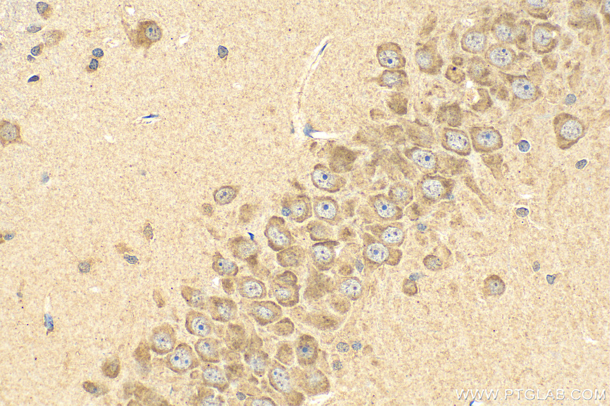 IHC staining of rat brain using 26423-1-AP