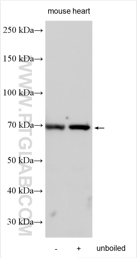 WB analysis using 26958-1-AP