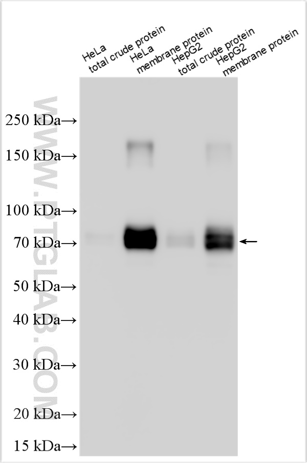 WB analysis using 22661-1-AP