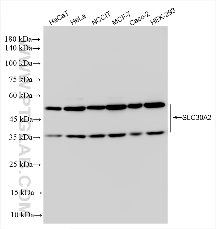 WB analysis using 83666-1-RR (same clone as 83666-1-PBS)