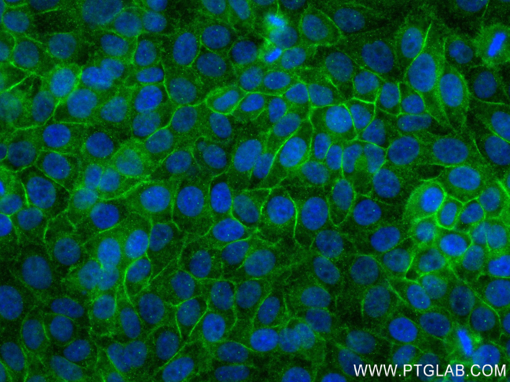 IF Staining of HepG2 using 83844-6-RR (same clone as 83844-6-PBS)