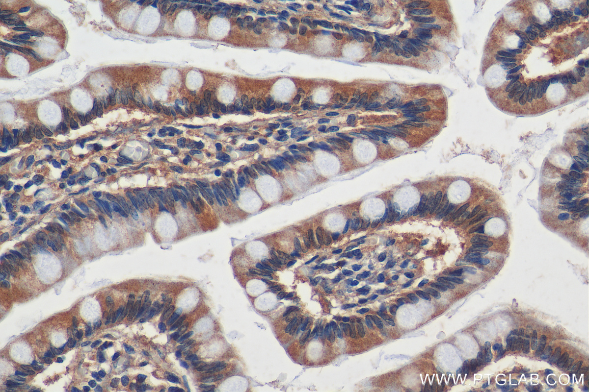 IHC staining of human small intestine using 24775-1-AP