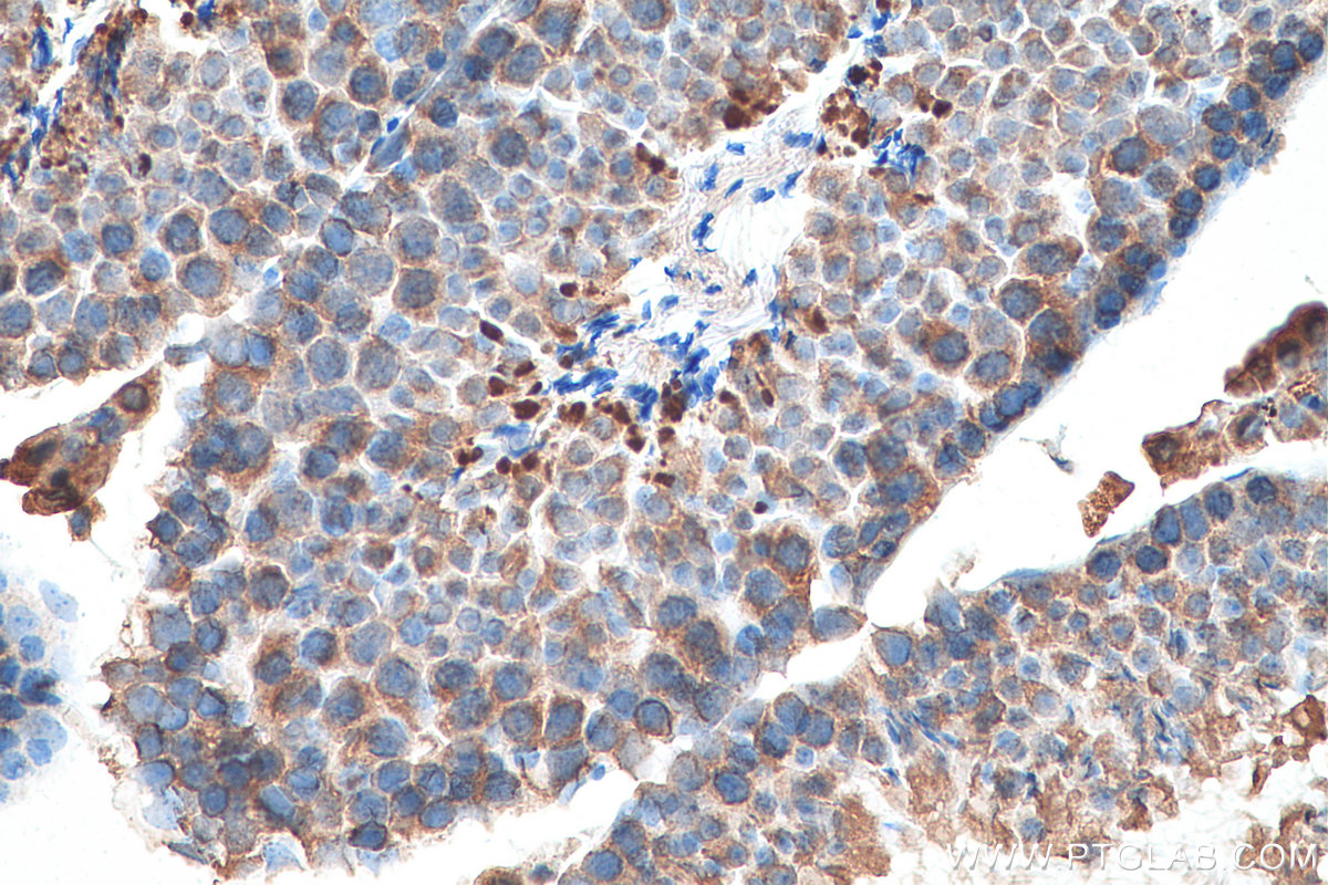 IHC staining of mouse testis using 67929-1-Ig (same clone as 67929-1-PBS)